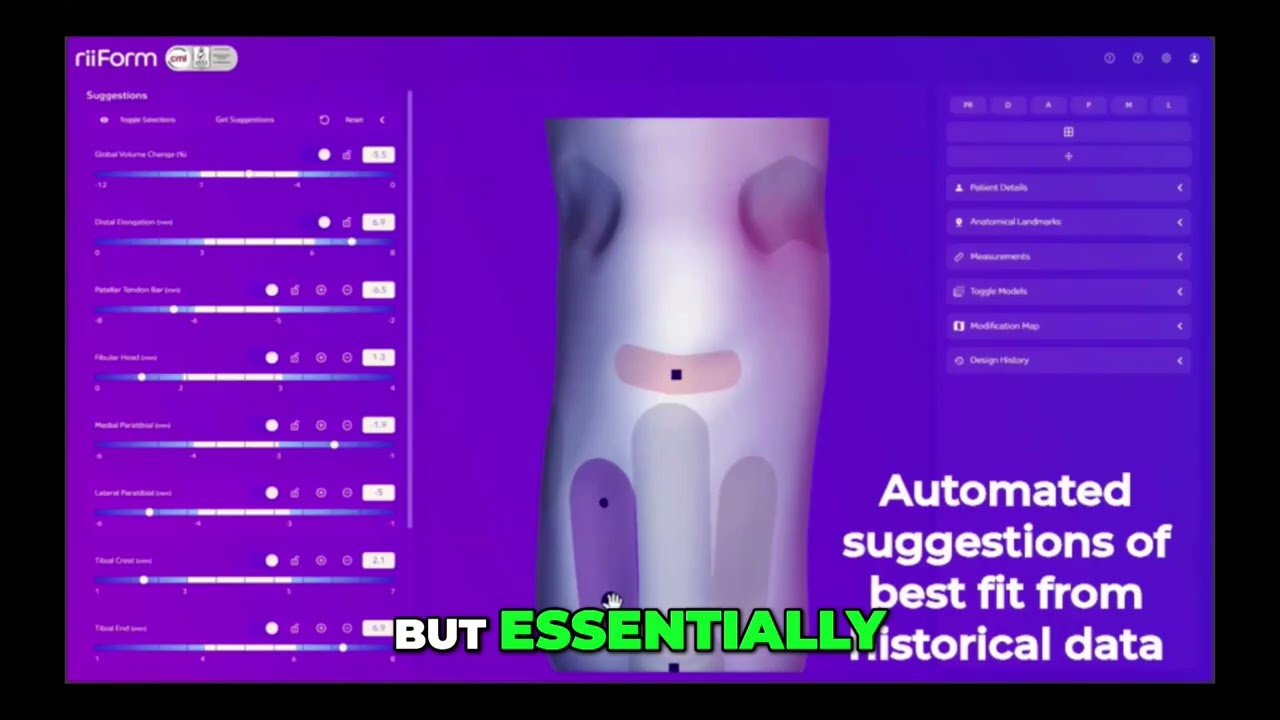 This New Tech Could Change Prosthetics Forever