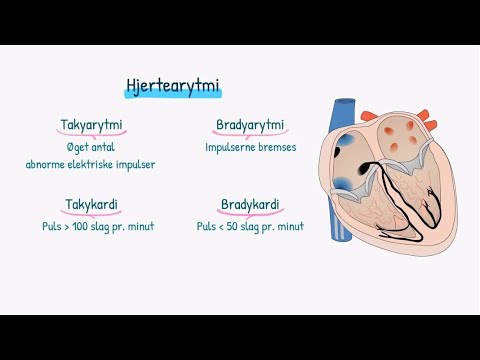 Video: Hvad er to livstruende arytmier?