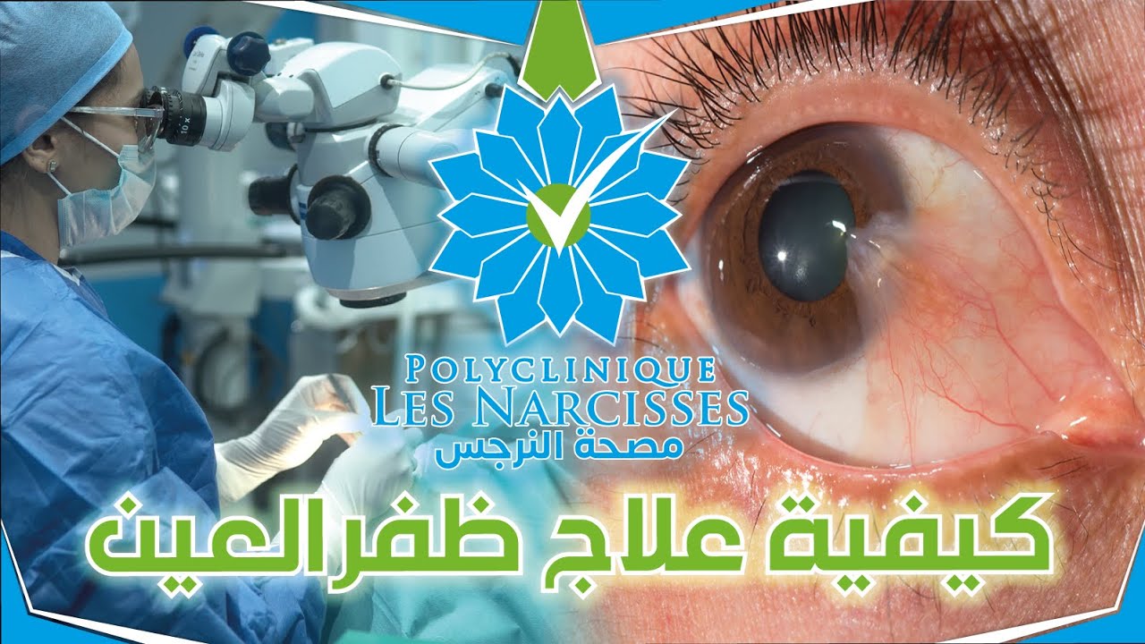 كيفية علاج ظفر العين - YouTube
