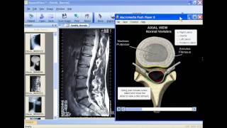 Image Management and Patient Consultation Software in HD