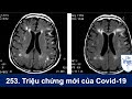 #253. Livestream chiều thứ Sáu Oct 9, 2020 AskDrWynn/Covid-19: Triệu chứng mới của bệnh Covid-19?