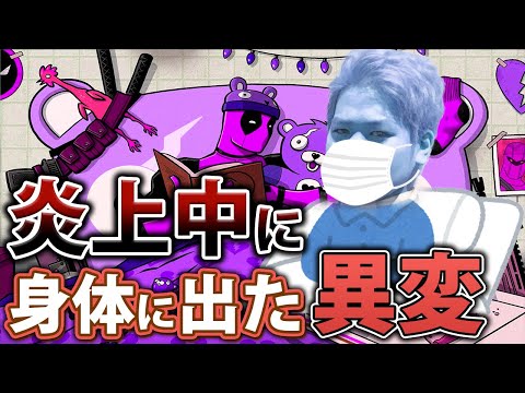 【こーすけ切り抜き】こーすけ炎上中に起きた体の症状【配信】