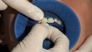 OptraDam PreDE v0.95PowerPoint_Hi.wmv