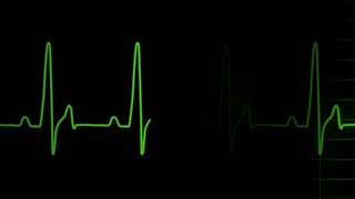 Heart rate Graph (1080p) •• No Copyright Videos