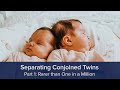 Separating Conjoined Twins Part 1: Rarer than One in a Million