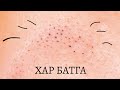 Хар батга хайлуулах “SKIN GRITTING METHOD”