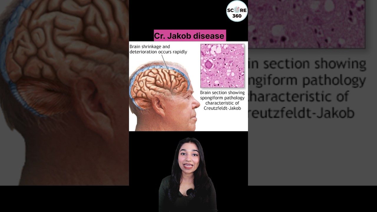 Prions |25 seconds  NCERT RAPID REVISION | Biological Classification class 11 | NEET 2026 