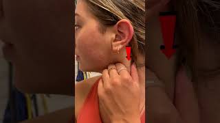 1 Sided Headache Relief