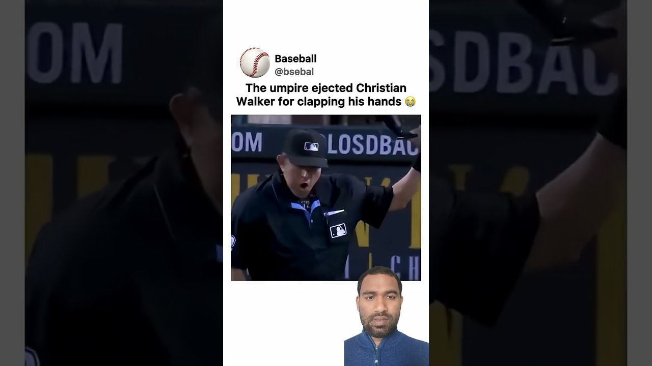 хлопает себя по голове 