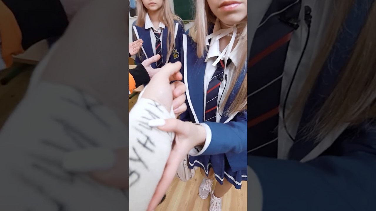 Мне сломали руку 🫣 