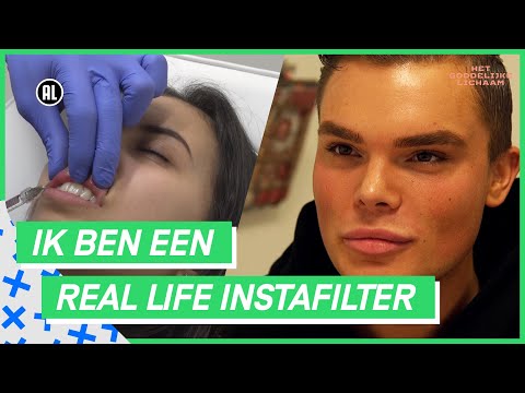 Video: Huis-2: Hoe Ziet Het Gezicht Van Daria Pynzar Eruit Na Plastische Chirurgie. Mooie Vrouw Of Slachtoffer Zoals De Anderen?