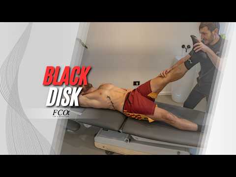 🏀 Low Back Pain in Basketball: When MRI Shows a "Black Disc"