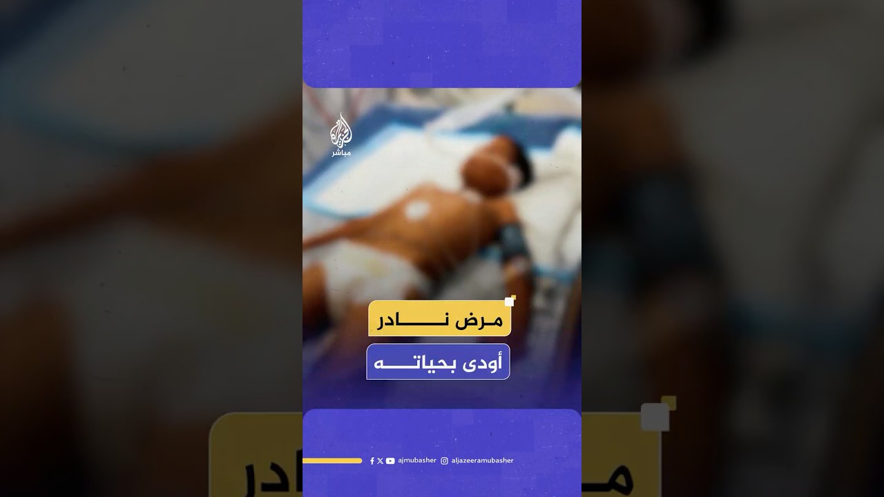 مرض نادر.. وفاة الطفل يوسف حسين على إثر إصابته بمتلازمة غيلان باريه في قطاع غزة
