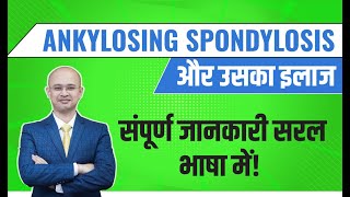 Ankylosing Spondylitis Treatment Options: What You Need to Know | Dr. Sushant Shinde