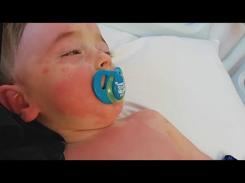 New COVID-19 Symptom Can Cause Inflammation in Children
