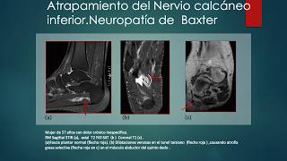 Case of the Month No. 10 July 2020, \