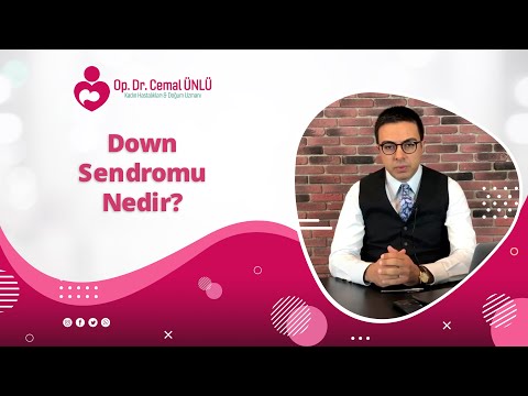 Video: Down sendromunun karyotipi nedir?