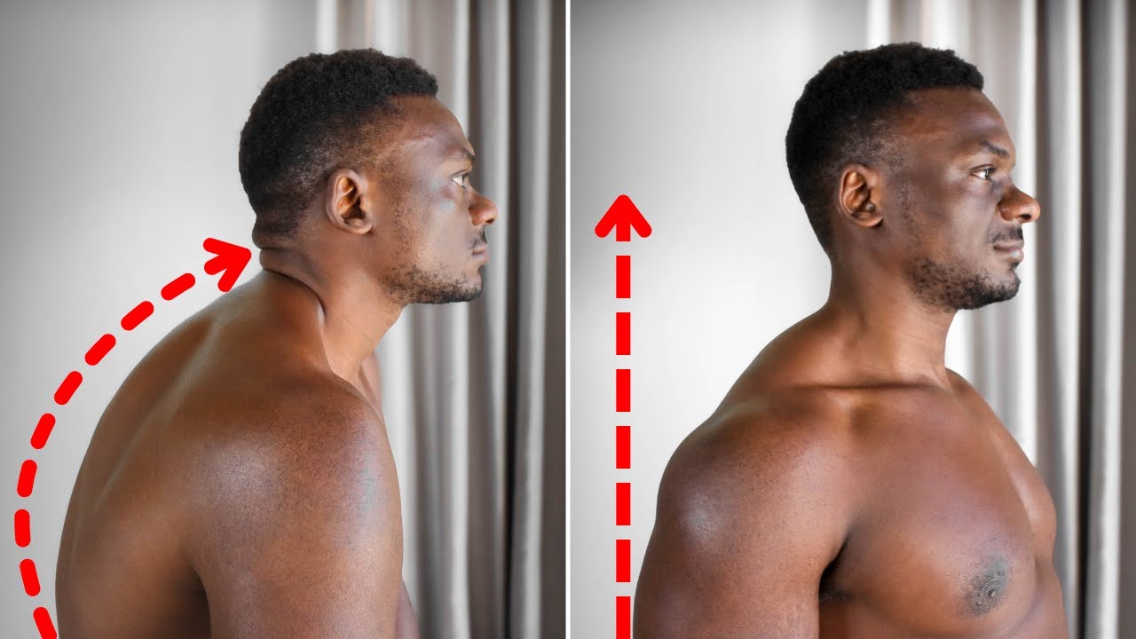 Exercises that Fixed My Terrible Back Posture (Fix Posture and Relieve ...