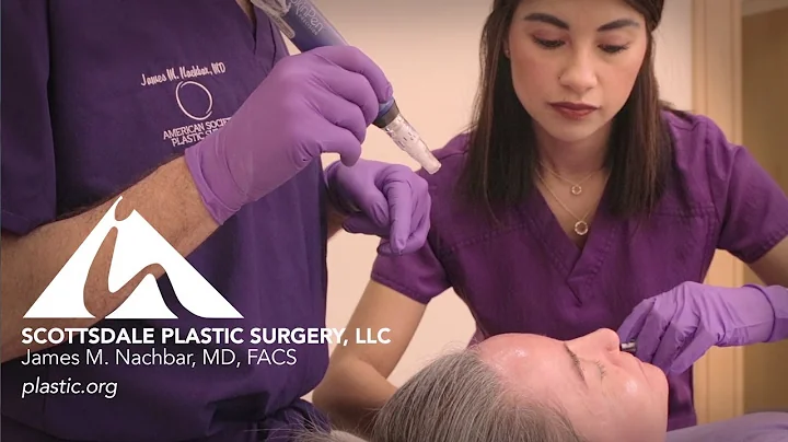 Facial rejuvenation, facelifts, and micro needling...