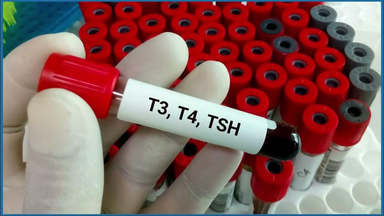 t3-t4-tsh