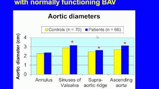 Bicuspid aortic valve: Prevalence, genetics and natural history.