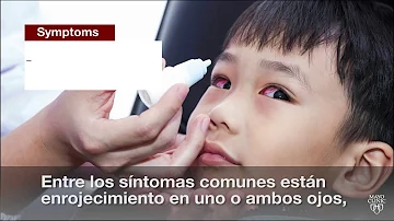 ¿Cuánto tiempo es demasiado para la conjuntivitis?