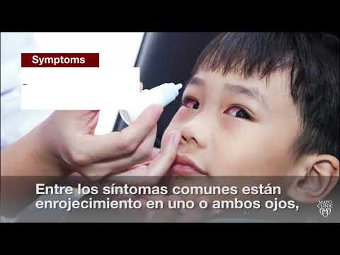 Vídeo: Com tractar la laringitis: 8 passos (amb imatges)