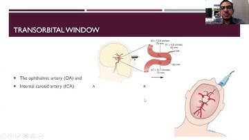 10. Transcranial Doppler   Introduction