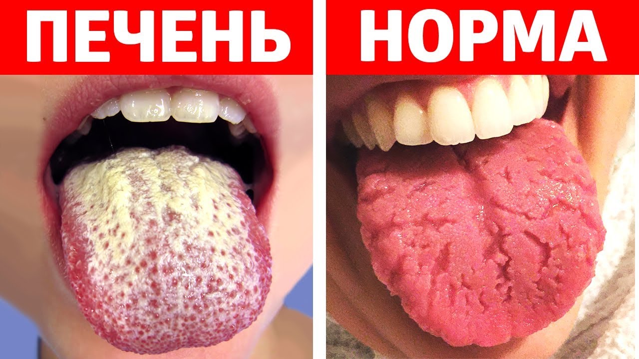 Язык Нормального Человека Фото