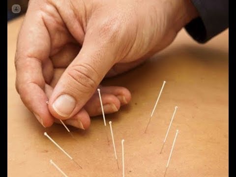 UTILIDAD DE LA ACUPUNTURA EN ONCOLOGIA Dr  Juan Muñoz