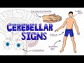 Cerebellar Dysfunction Signs Mnemonic - DANISH: What are the Signs of Cerebellar Dysfunction?