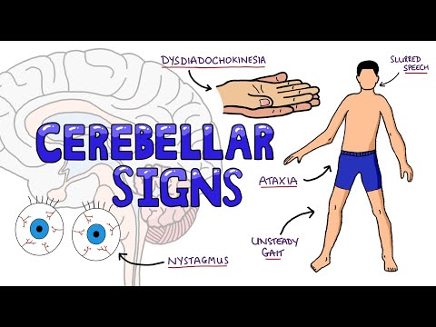 Video: Hoekom is serebellêre tekens ipsilateraal?