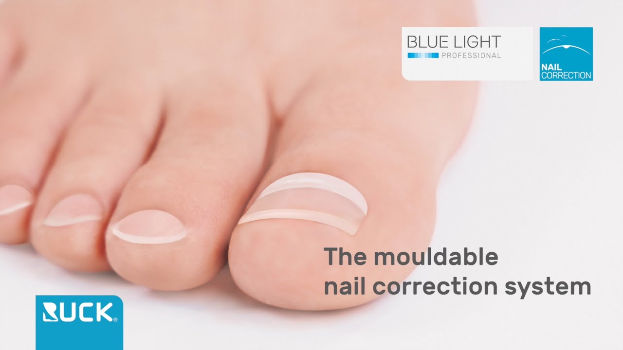 BLUE LIGHT professional – the mouldable nail correction system from RUCK