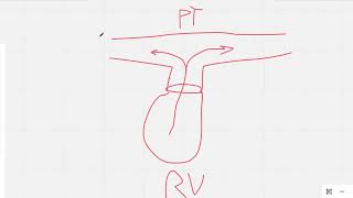 (Pre)Test Q44 - Resp - Sleep Apnea