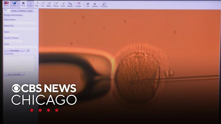 Scientists use human skin cells to create eggs in possible fertility breakthrough