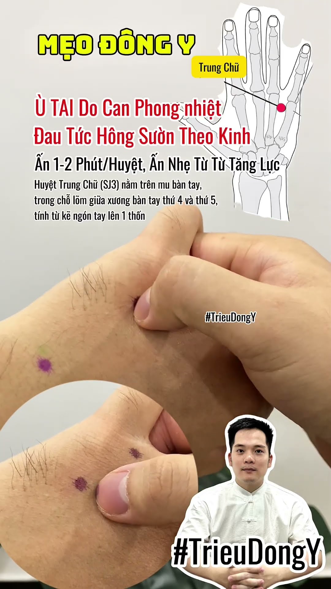 Huyệt Trung Chữ Chữa Ù Tai, Đau Tức Hông Sườn 🇻🇳
