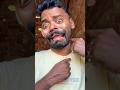 Baby cute Injection 😂😭😰💉🩸#funny #comedy #funnyvideo #funnymoments #injection #injection_funny