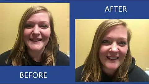 Patient Stories: Rebecca | Hamilton Family Dentistry