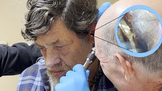 Get That Out of My Ear!