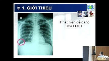 Phiên 3 Hình ảnh Ung thư vùng cổ-ngực [Hội thảo Hình ảnh học Ung bướu Cần Thơ 2023]