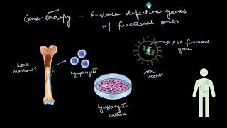 Gene therapy | Biotechnology and its Applications | Biology | Khan Academy