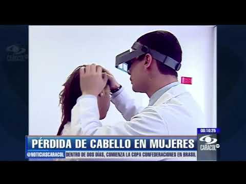 Video: ¿Las diademas provocan caída del cabello?