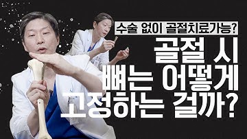 (*Eng) 골절수술 더 편리해질 수 있을까? 역사를 통해 본 뼈 이야기 - 골절수술편 -