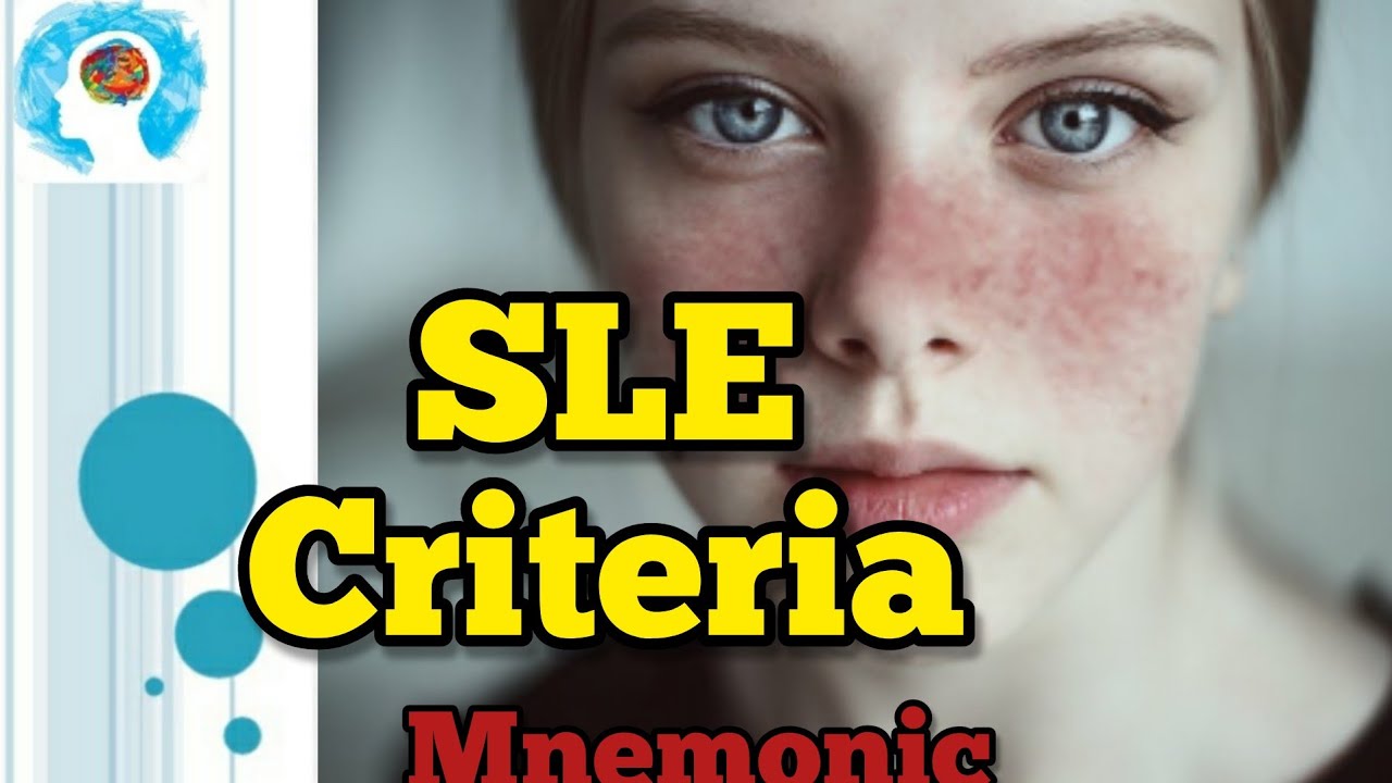SLE Criteria Mnemonic YouTube