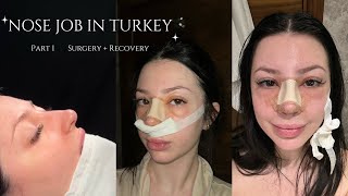 I Got a RHINOPLASTY in Turkey! Part 1 | Nose Job Vlog + Exploring Turkey | 2024 | Dr Sedat Ruzgar