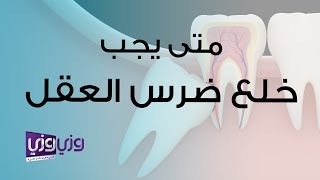 متى يجب خلع ضرس العقل ونصائح عامة بعد الخلع Youtube