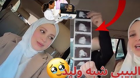 حصريا 🚨 آخر زيارة لوليد ونور مقداد  للطبيبة قبل الولادة - الاستعدادات النهائية 😍