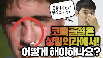 코뼈골절은 성형외과에서! 어떻게 해야하나요...? [성형 알려주는 남자 이용석]