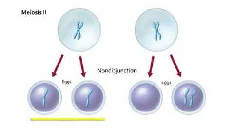 Non Disjunction in Meiosis | Non disjunction Meiosis