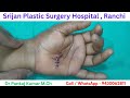Hand injury surgery in Ranchi| Repair of Tendon injury| Repair of nerve injury| Hand surgery in